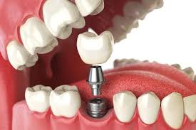Child Dentistry