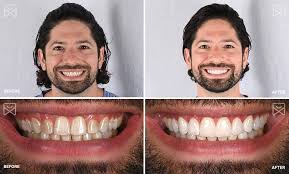 Best Cosmetic Dentistry