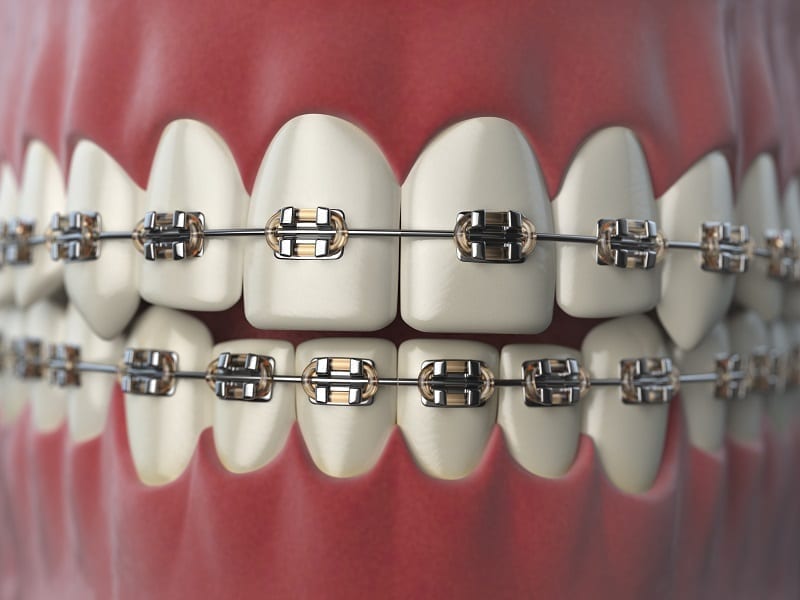 Dental Implant Clinic